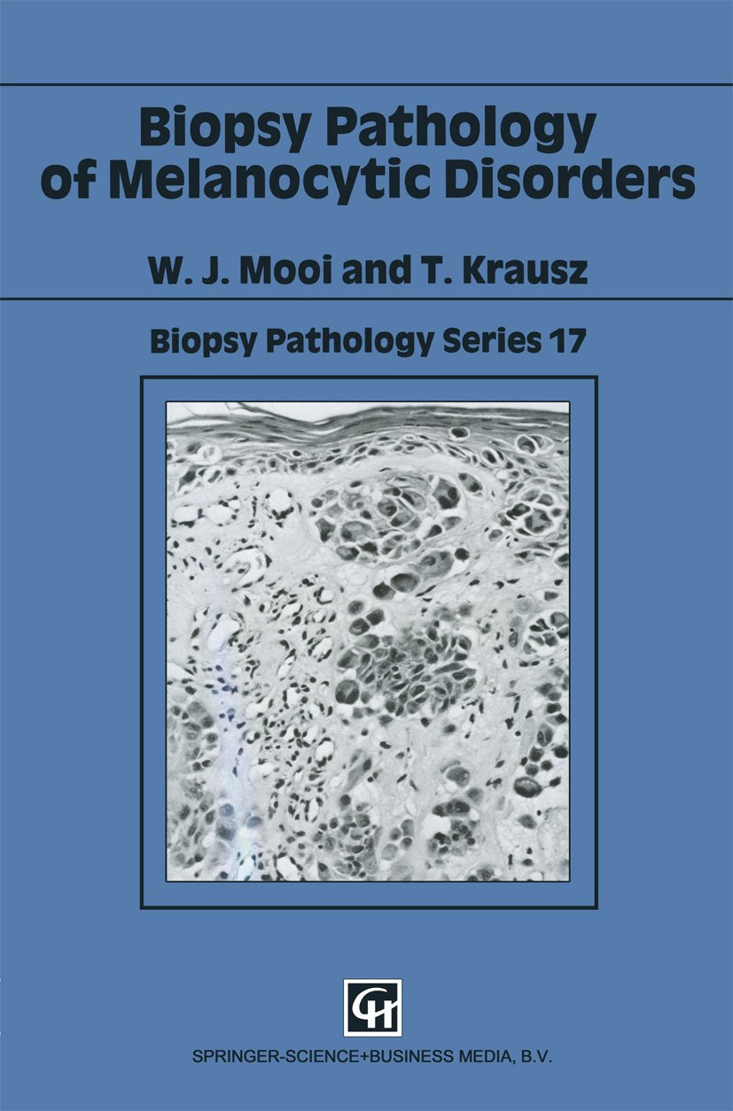 Biopsy Pathology Series
