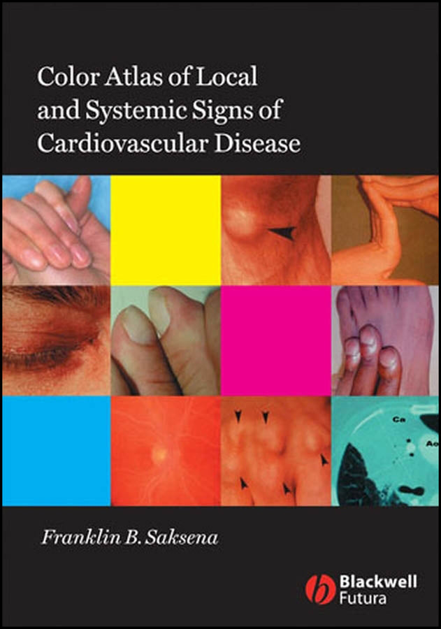 Color Atlas of Local and Systemic Manifestations of Cardiovascular Disease