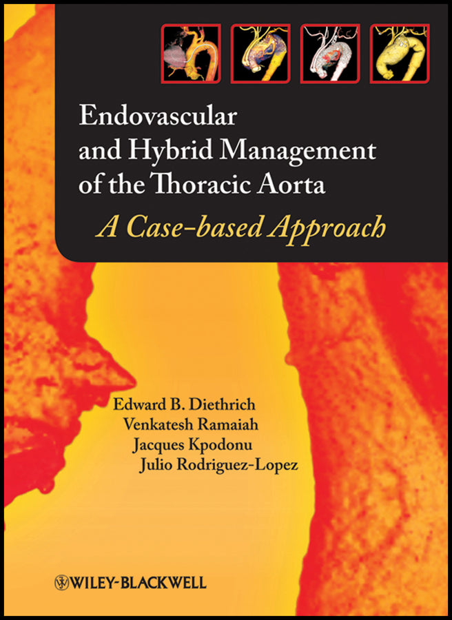 Endovascular and Hybrid Management of the Thoracic Aorta