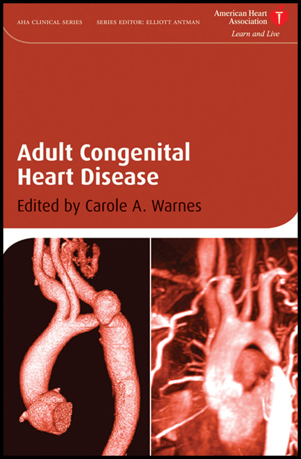 Adult Congenital Heart Disease