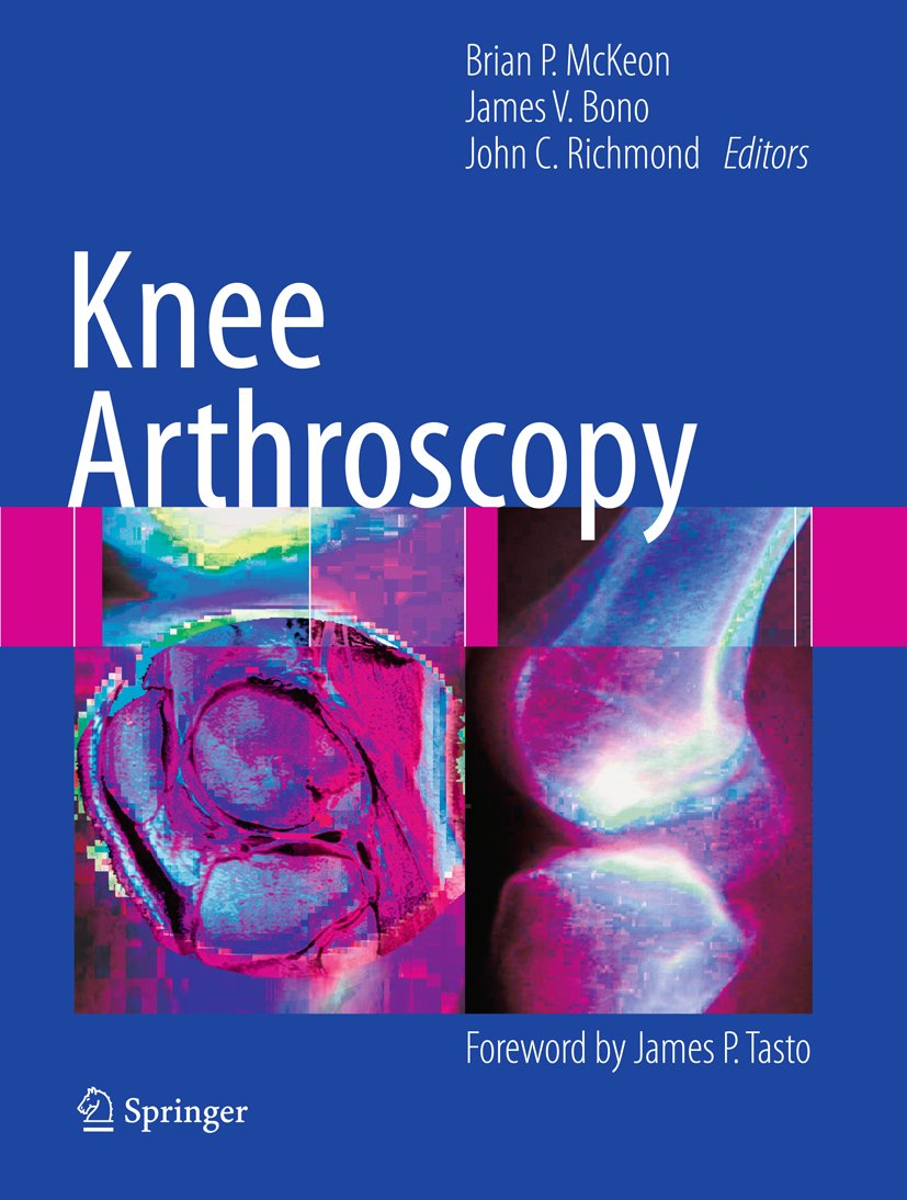 Knee Arthroscopy