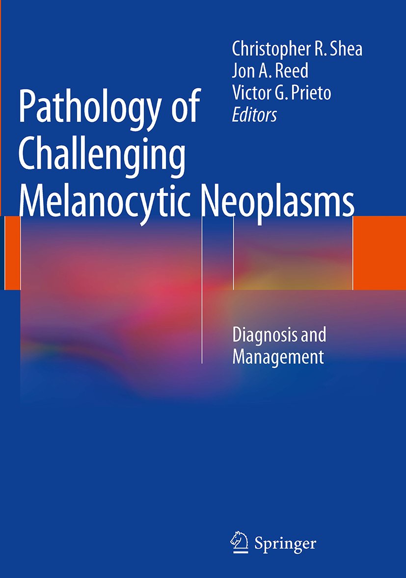 Pathology of Challenging Melanocytic Neoplasms