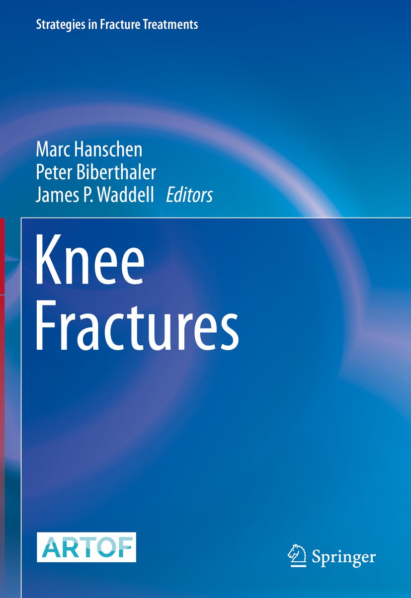 Strategies in Fracture Treatments