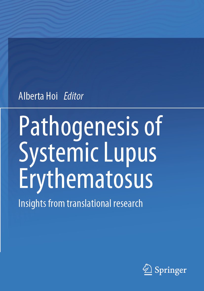 Pathogenesis of Systemic Lupus Erythematosus