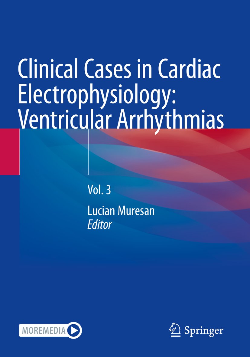 Clinical Cases in Cardiac Electrophysiology: Ventricular Arrhythmias