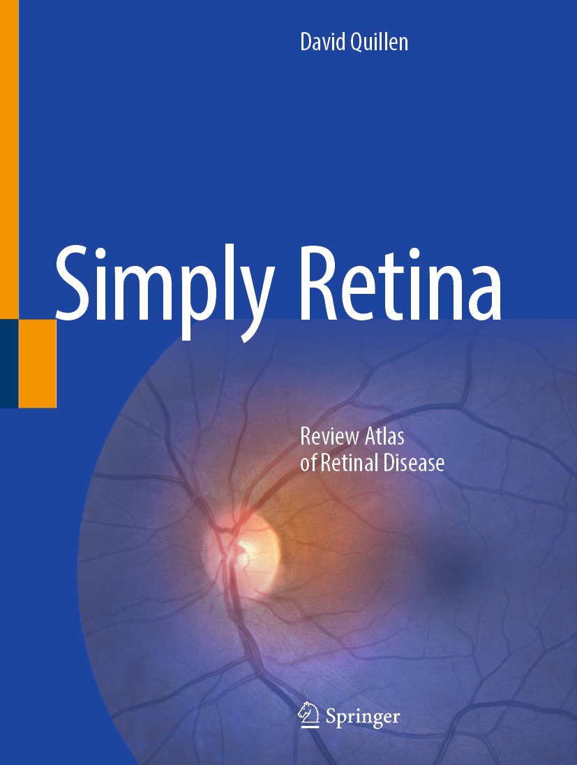 Simply Retina