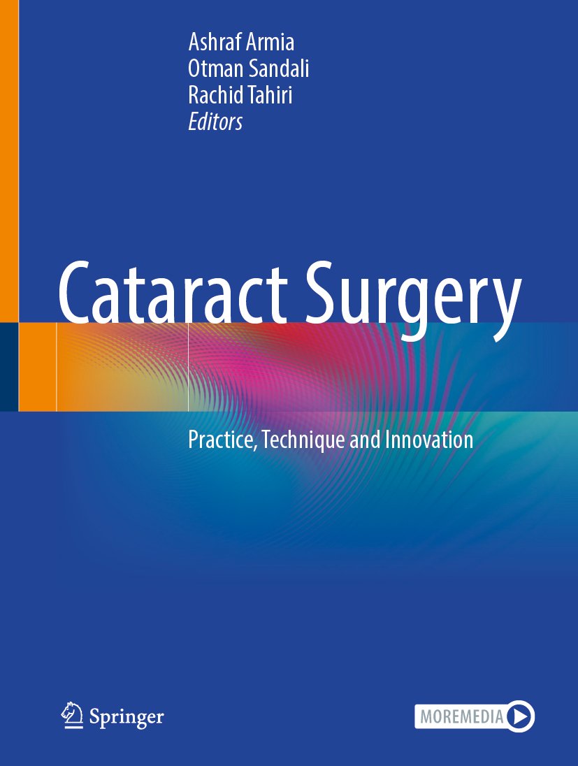 Cataract Surgery