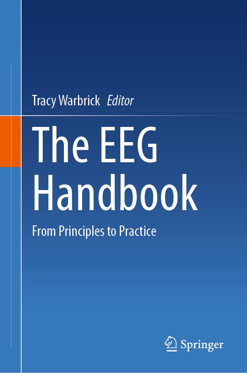 The EEG Handbook