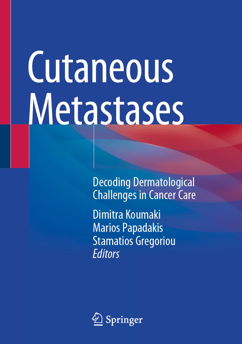 Cutaneous Metastases