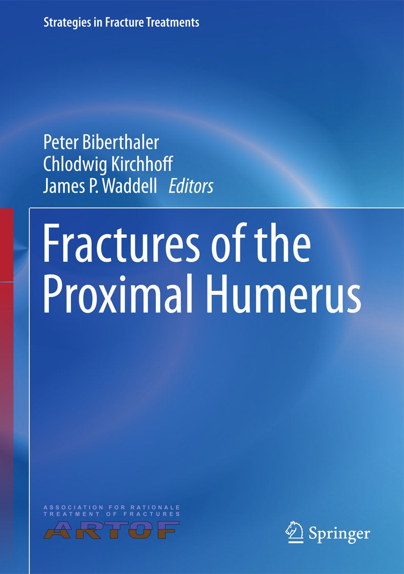 Strategies in Fracture Treatments