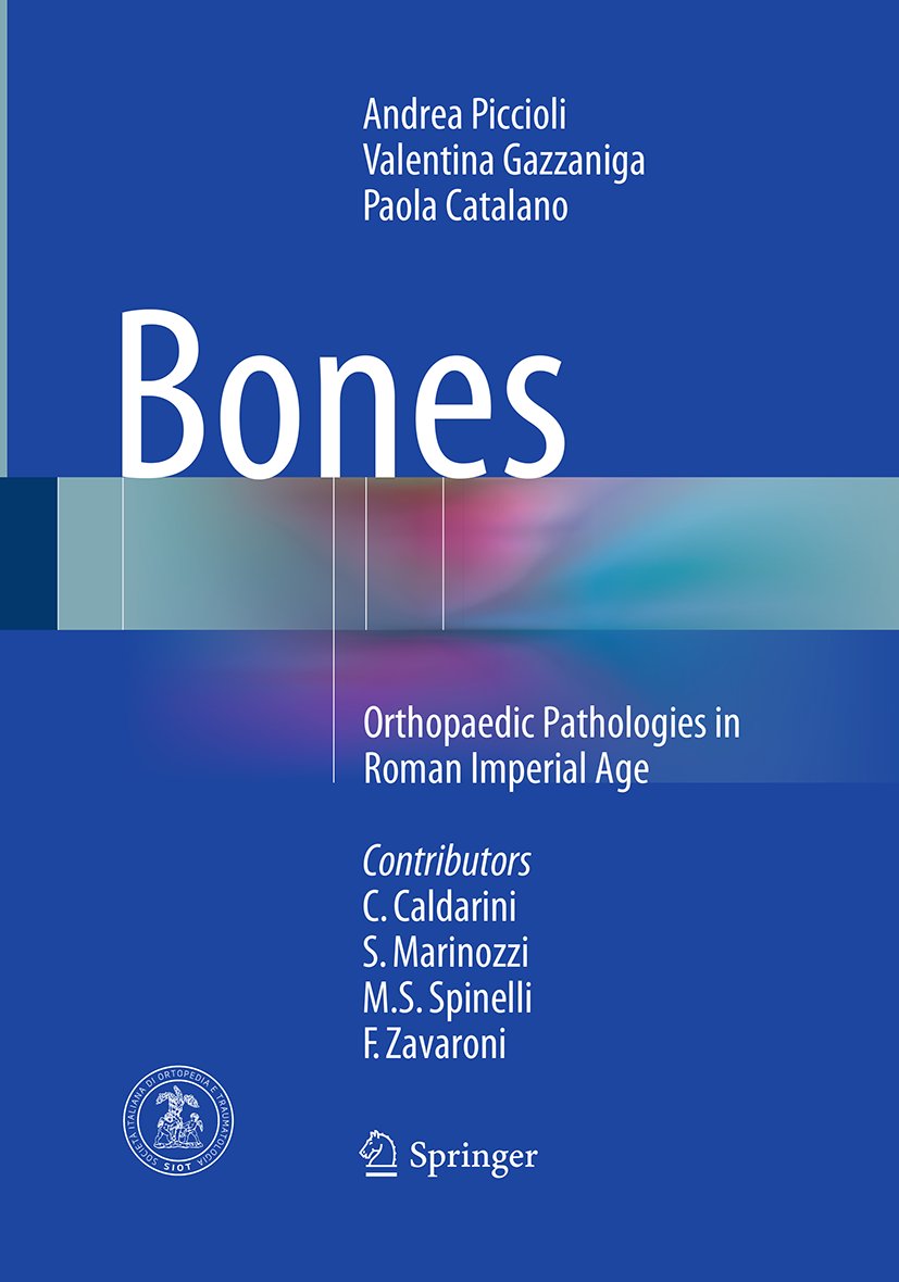 Bones