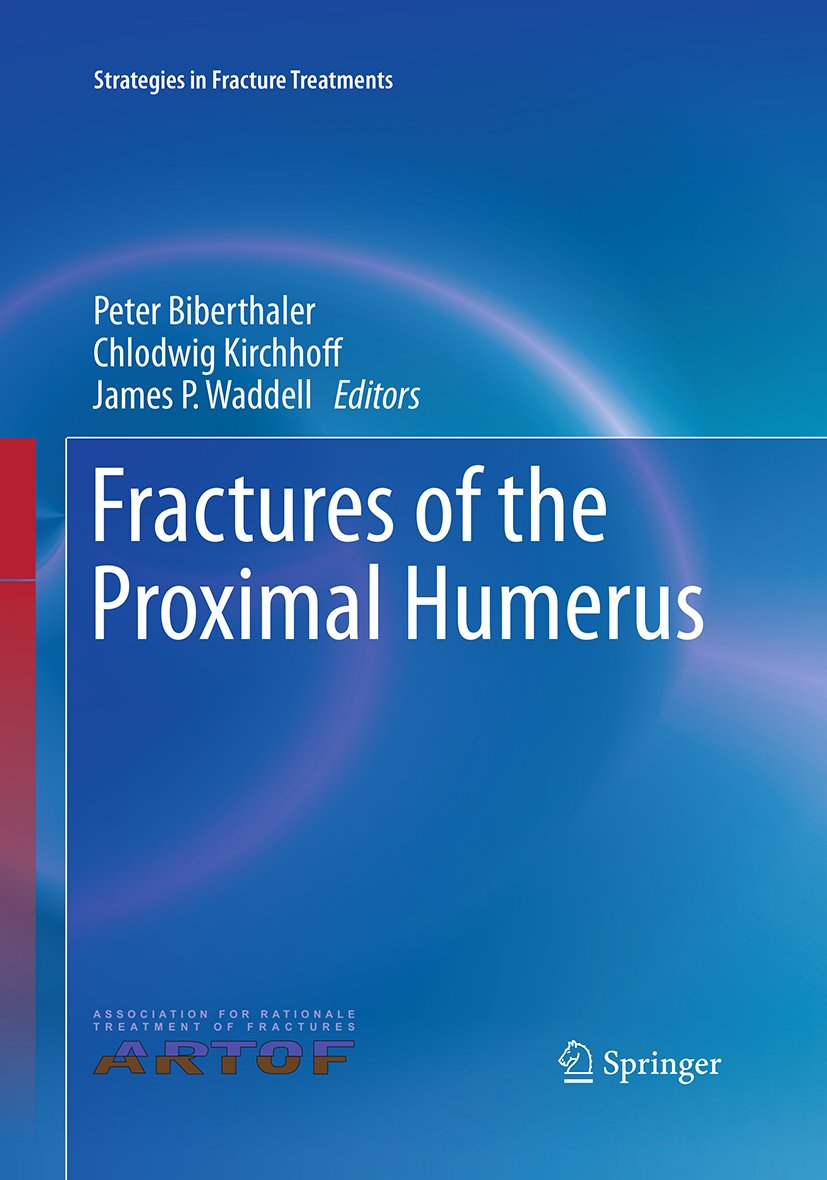 Strategies in Fracture Treatments