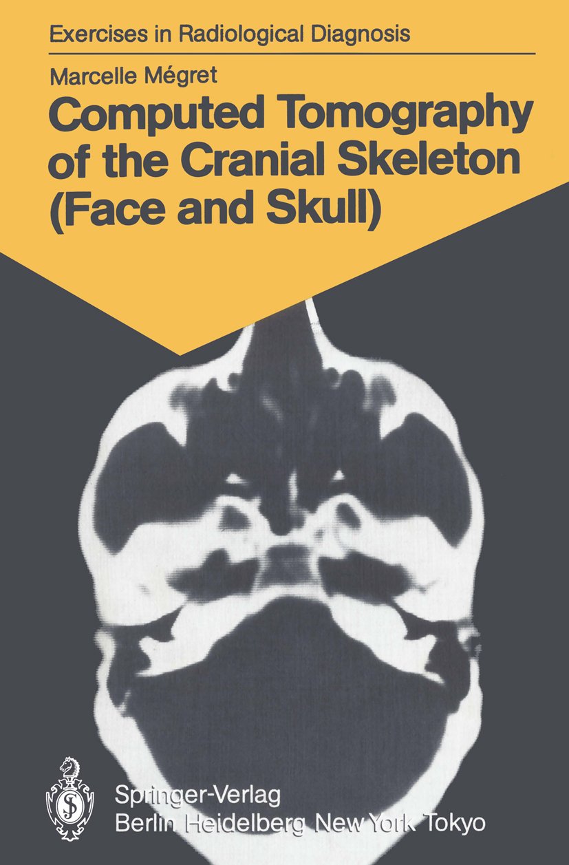 Computed Tomography of the Cranial Skeleton (Face and Skull)