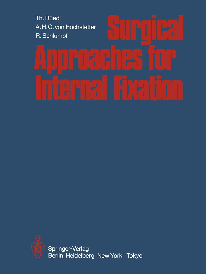 Surgical Approaches for Internal Fixation