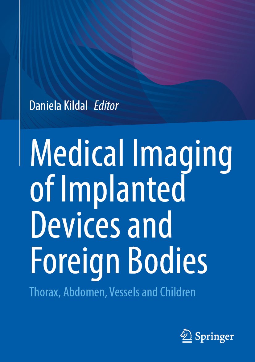 Medical Imaging of Implanted Devices and Foreign Bodies