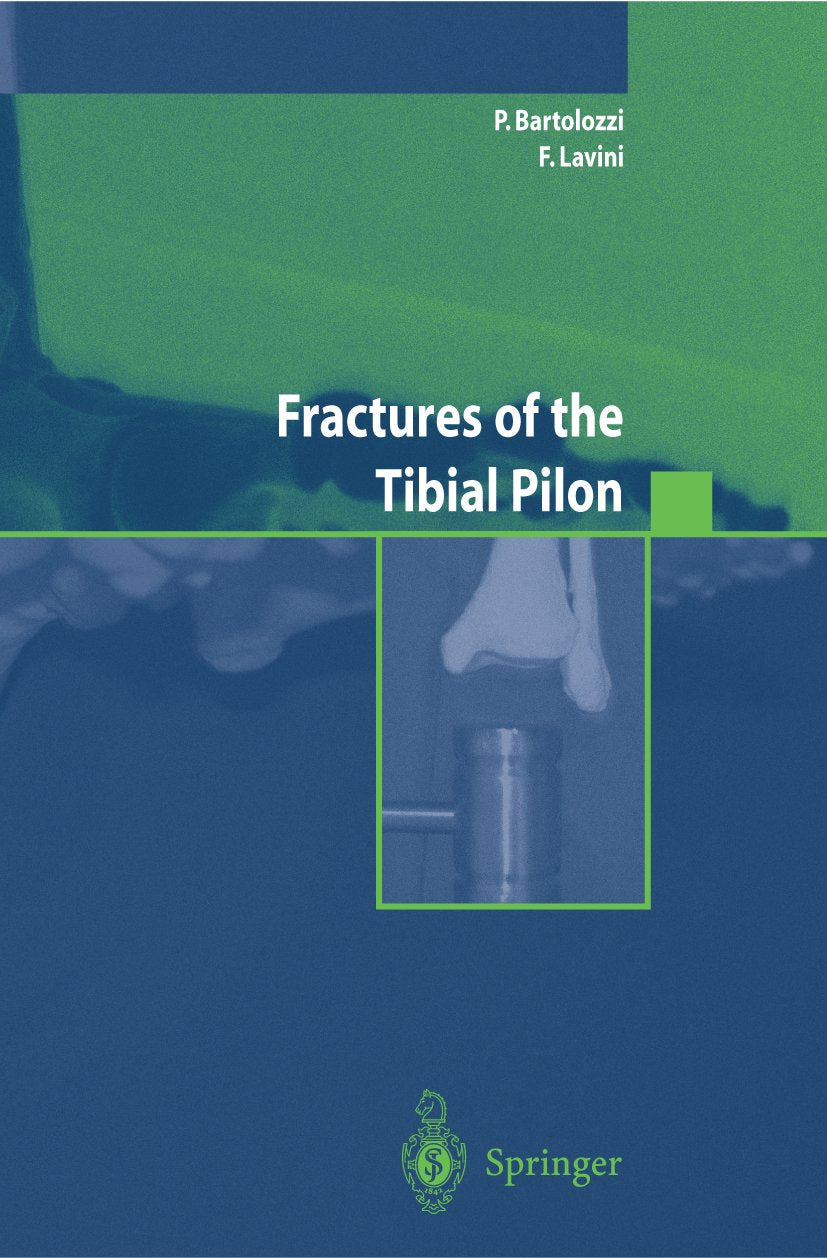 Fractures of the Tibial Pilon
