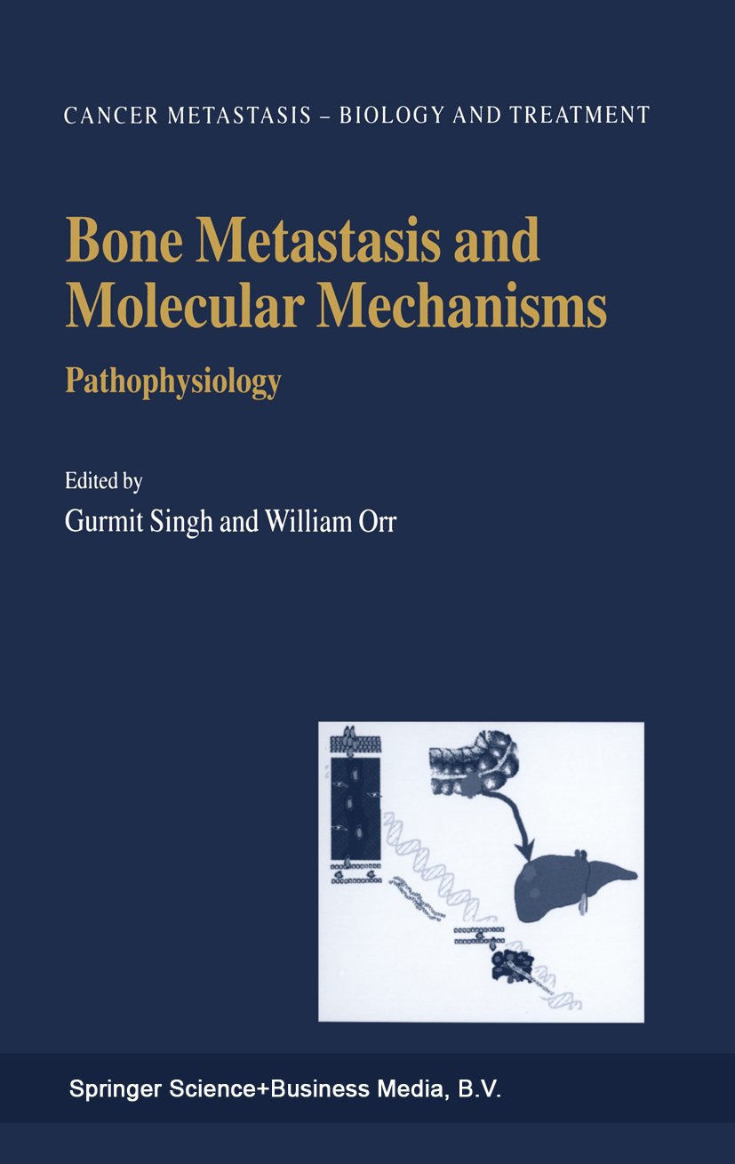 Cancer Metastasis - Biology and Treatment