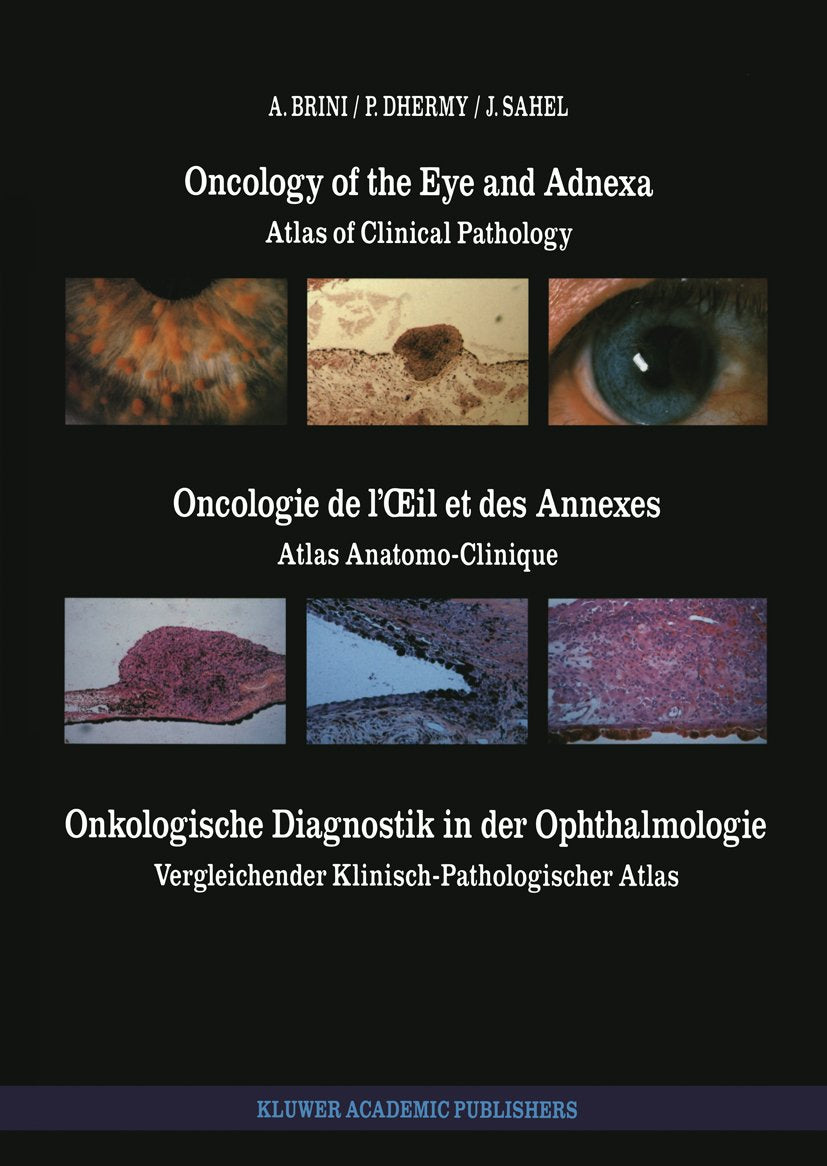 Monographs in Ophthalmology