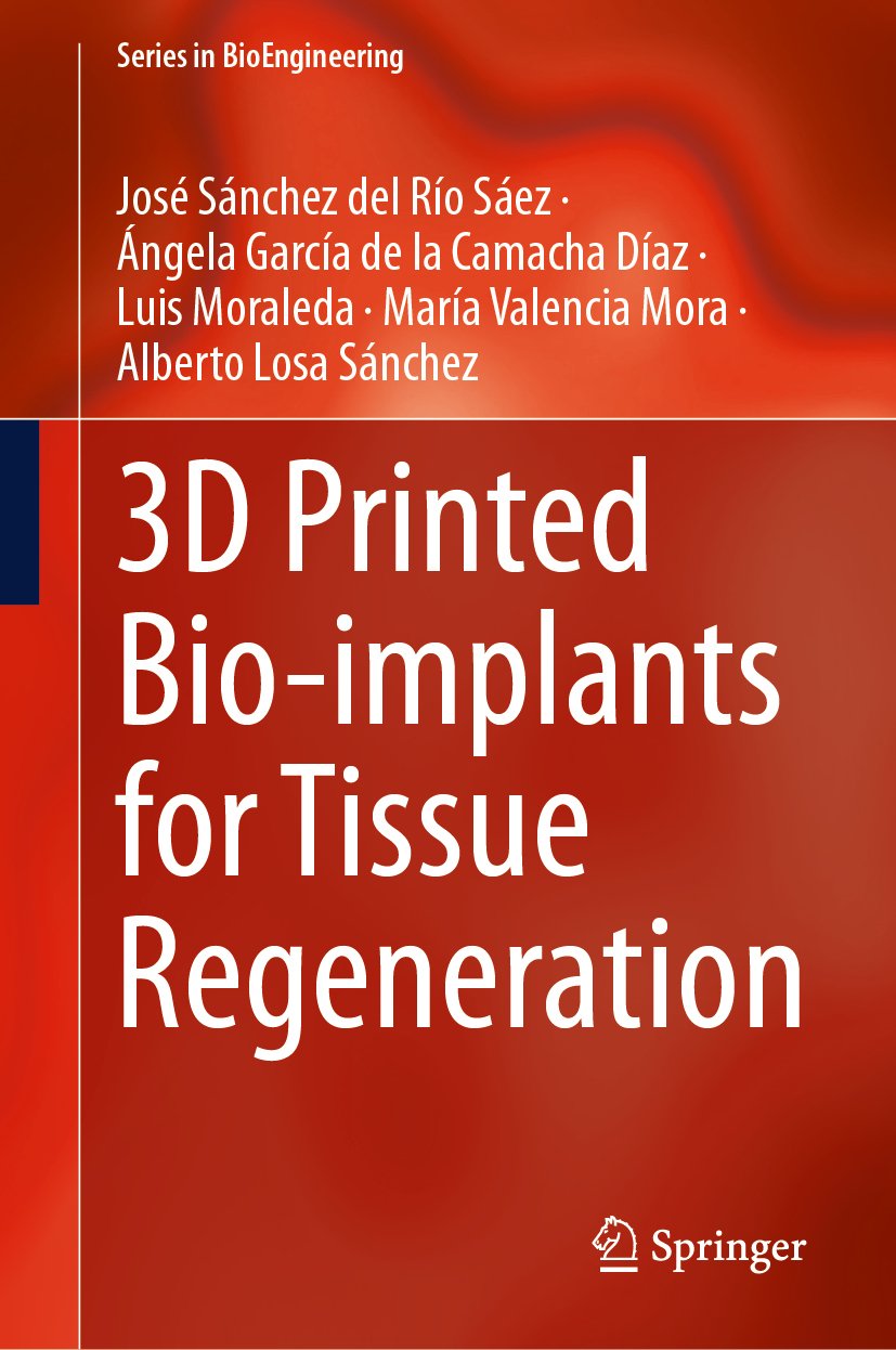 3D Printed Bio-implants for Tissue Regeneration